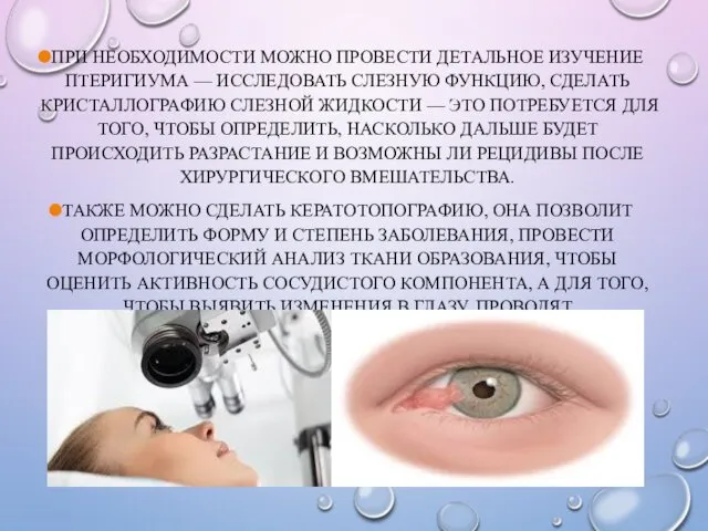 ПРИ НЕОБХОДИМОСТИ МОЖНО ПРОВЕСТИ ДЕТАЛЬНОЕ ИЗУЧЕНИЕ ПТЕРИГИУМА — ИССЛЕДОВАТЬ СЛЕЗНУЮ ФУНКЦИЮ,