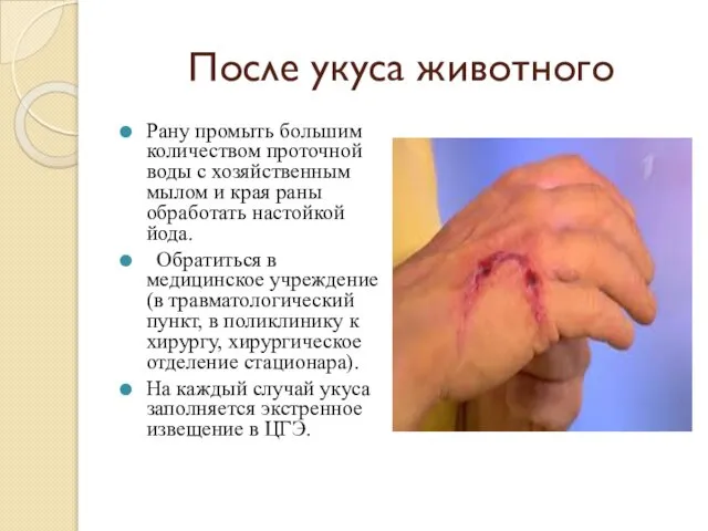 После укуса животного Рану промыть большим количеством проточной воды с хозяйственным