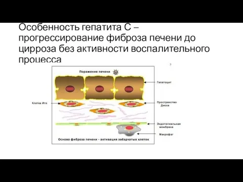 Особенность гепатита С – прогрессирование фиброза печени до цирроза без активности воспалительного процесса