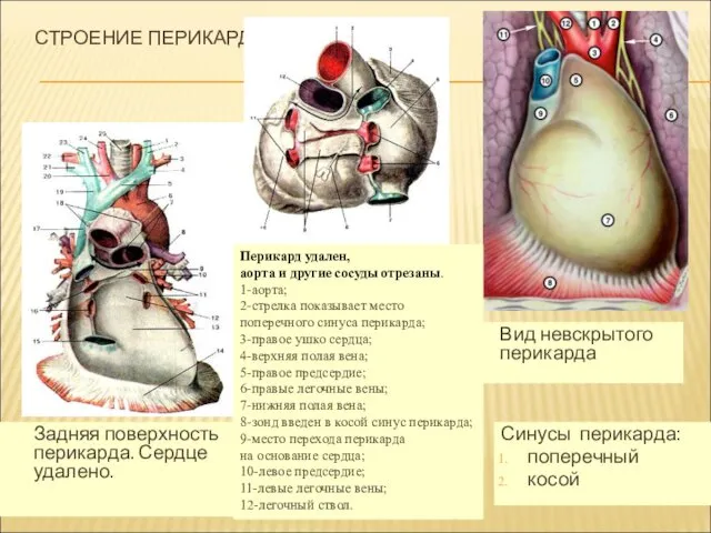 СТРОЕНИЕ ПЕРИКАРДА Синусы перикарда: поперечный косой Задняя поверхность перикарда. Сердце удалено.