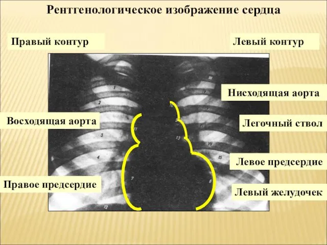 Правое предсердие Восходящая аорта Нисходящая аорта Легочный ствол Левое предсердие Левый