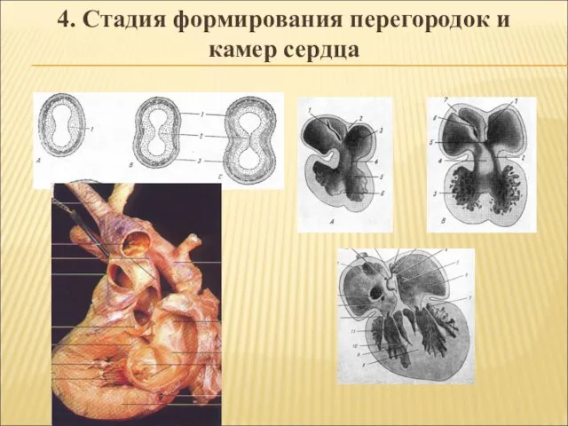 4. Стадия формирования перегородок и камер сердца