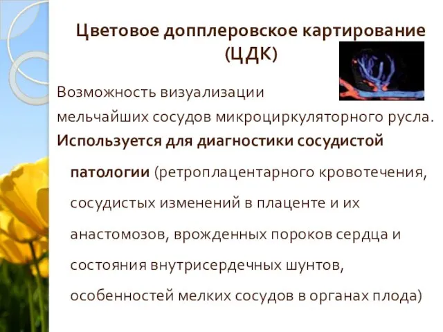 Цветовое допплеровское картирование (ЦДК) Возможность визуализации мельчайших сосудов микроциркуляторного русла. Используется