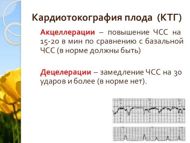 Кардиотокография плода (КТГ) Акцеллерации – повышение ЧСС на 15-20 в мин