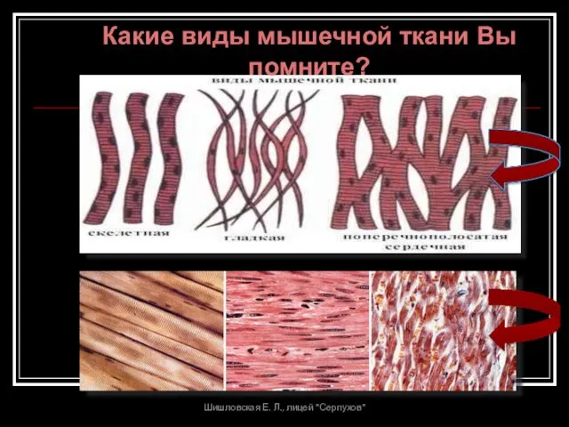 Какие виды мышечной ткани Вы помните? Шишловская Е. Л., лицей "Серпухов"