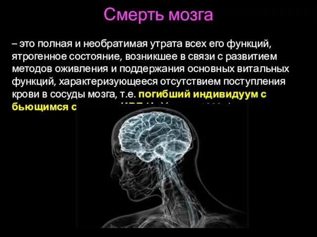 Смерть мозга – это полная и необратимая утрата всех его функций,