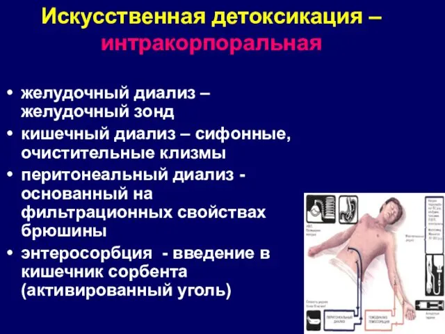 Искусственная детоксикация –интракорпоральная желудочный диализ – желудочный зонд кишечный диализ –