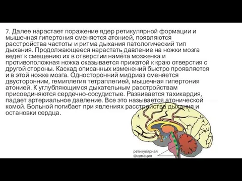 7. Далее нарастает поражение ядер ретикулярной формации и мышечная гипертония сменяется