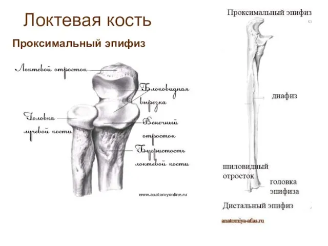 Локтевая кость Проксимальный эпифиз