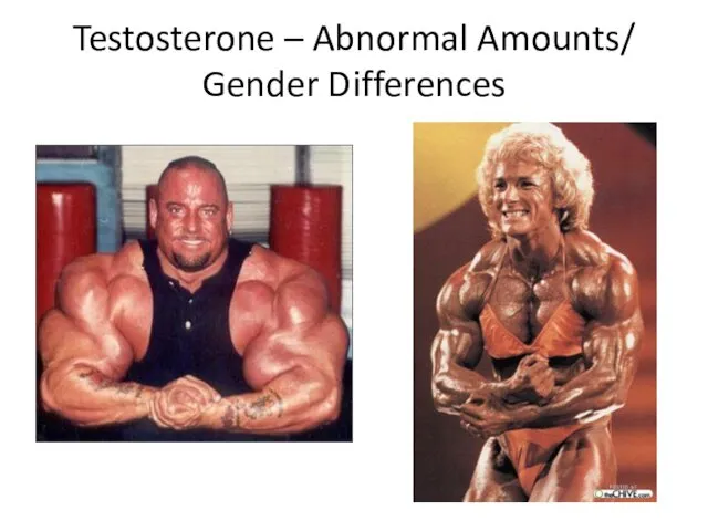 Testosterone – Abnormal Amounts/ Gender Differences