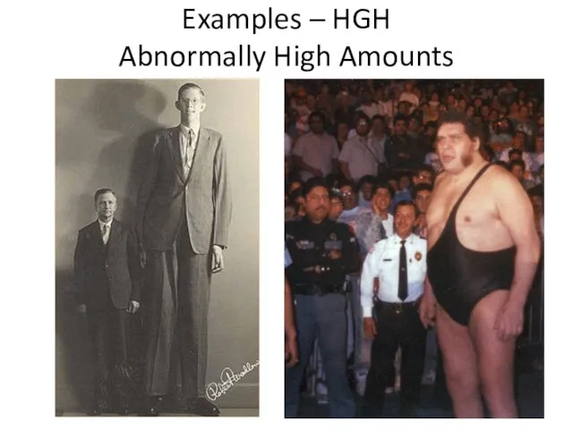 Examples – HGH Abnormally High Amounts