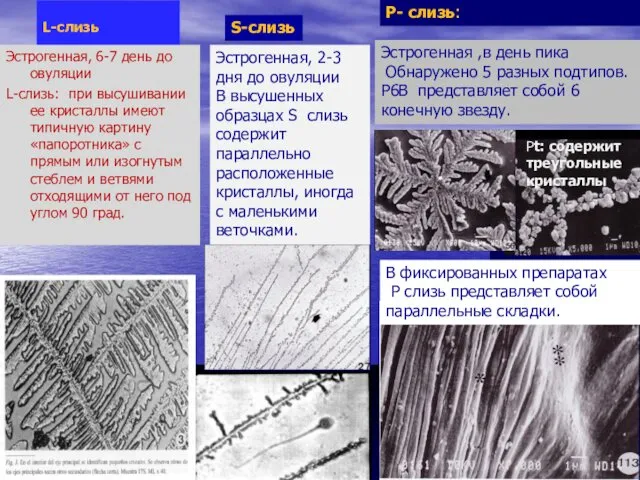 L-cлизь Эстрогенная, 6-7 день до овуляции L-слизь: при высушивании ее кристаллы