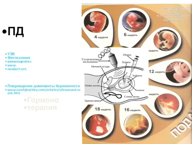 Закладка И развитие женской детородной системы начинается в ранние сроки эмбриогенеза.