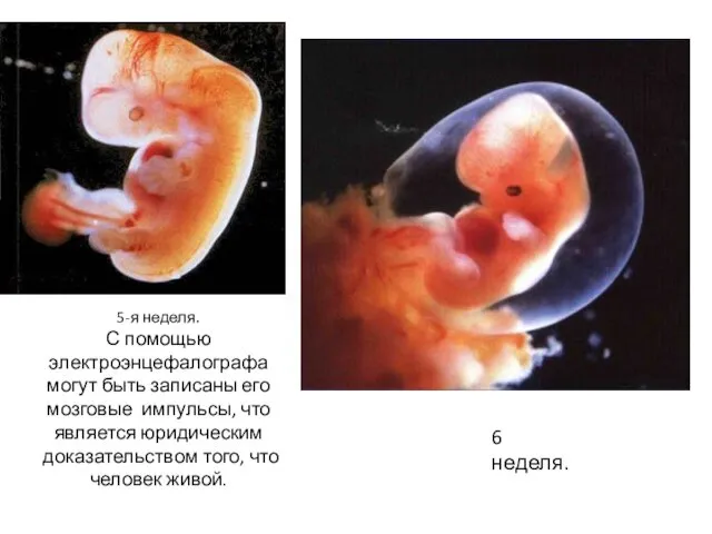 5-я неделя. С помощью электроэнцефалографа могут быть записаны его мозговые импульсы,