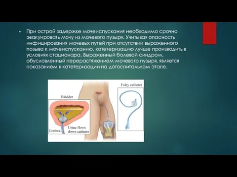 При острой задержке мочеиспускания необходимо срочно эвакуировать мочу из мочевого пузыря.