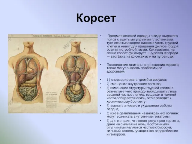 Корсет Предмет женской одежды в виде широкого пояса с вшитыми упругими