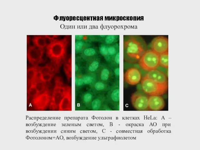 Флуоресцентная микроскопия Один или два флуорохрома Распределение препарата Фотолон в клетках