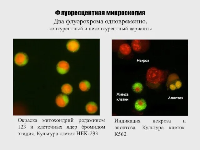 Окраска митохондрий родамином 123 и клеточных ядер бромидом этидия. Культура клеток