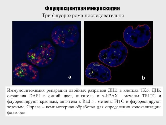 Флуоресцентная микроскопия Три флуорохрома последовательно Иммуноцитохимия репарации двойных разрывов ДНК в