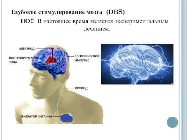 Глубокое стимулирование мозга (DBS) НО!! В настоящее время является экспериментальным лечением.