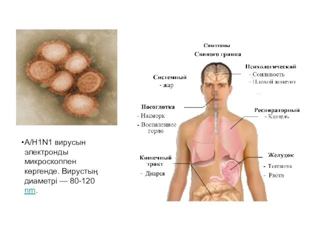 A/H1N1 вирусын электронды микроскоппен көргенде. Вирустың диаметрі — 80-120 nm.