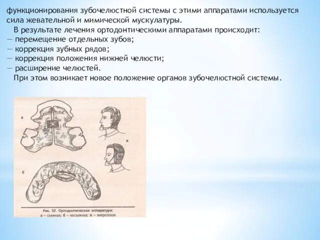 функционирования зубочелюстной системы с этими аппаратами используется сила жевательной и мимической