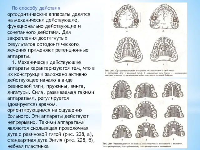 По способу действия ортодонтические аппараты делятся на механически действующие, функционально действующие