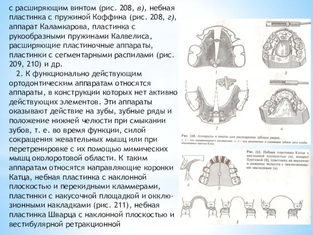 с расширяющим винтом (рис. 208, в), небная пластинка с пружиной Коффина