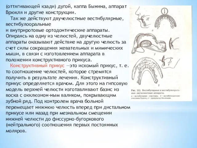 (оттягивающей кзади) дугой, каппа Бынина, аппарат Врюкля и другие конструкции. Так