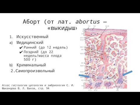 Аборт (от лат. abortus — «выкидыш») Искусственный Медицинский Ранний (до 12