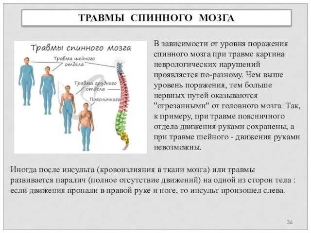 ТРАВМЫ СПИННОГО МОЗГА В зависимости от уровня поражения спинного мозга при