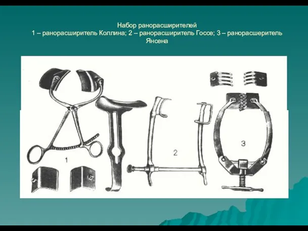 Набор ранорасширителей 1 – ранорасширитель Коллина; 2 – ранорасширитель Госсе; 3 – ранорасшеритель Янсена