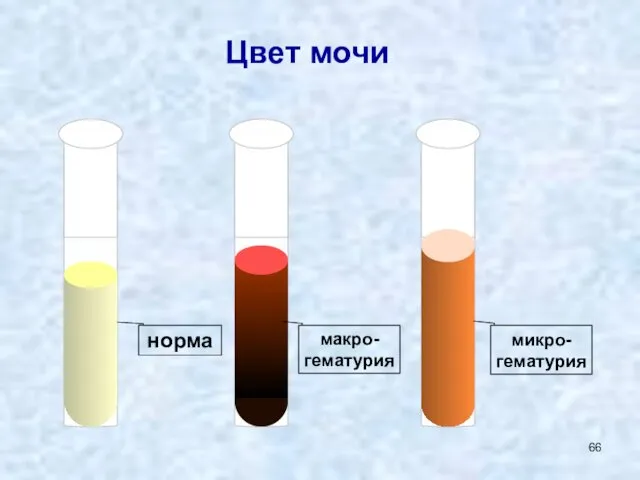 Цвет мочи