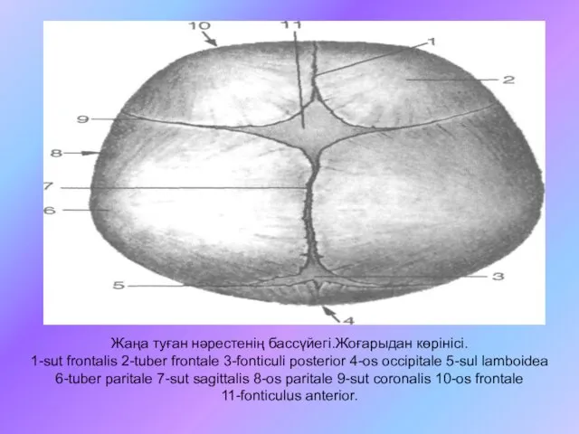 Жаңа туған нәрестенің бассүйегі.Жоғарыдан көрінісі. 1-sut frontalis 2-tuber frontale 3-fonticuli posterior