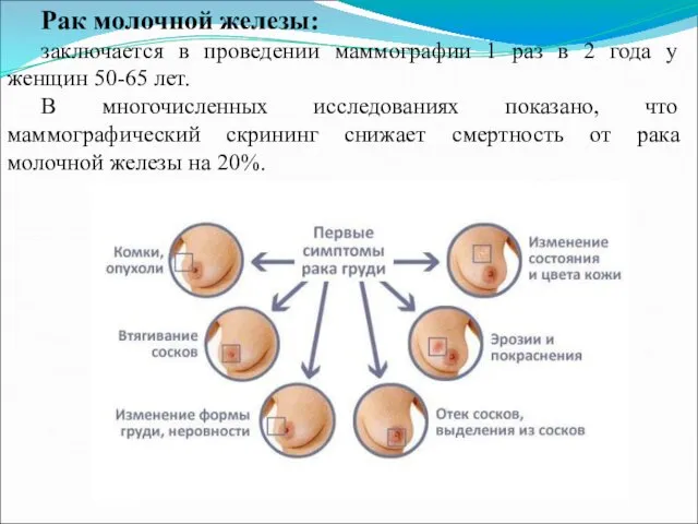 Рак молочной железы: заключается в проведении маммографии 1 раз в 2