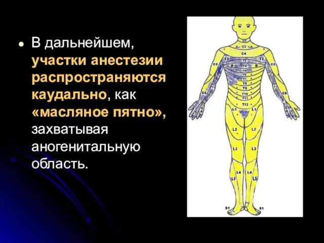 В дальнейшем, участки анестезии распространяются каудально, как «масляное пятно», захватывая аногенитальную область.