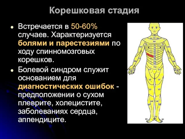 Корешковая стадия Встречается в 50-60% случаев. Характеризуется болями и парестезиями по