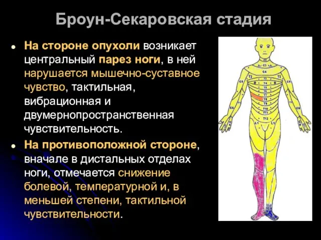 Броун-Секаровская стадия На стороне опухоли возникает центральный парез ноги, в ней