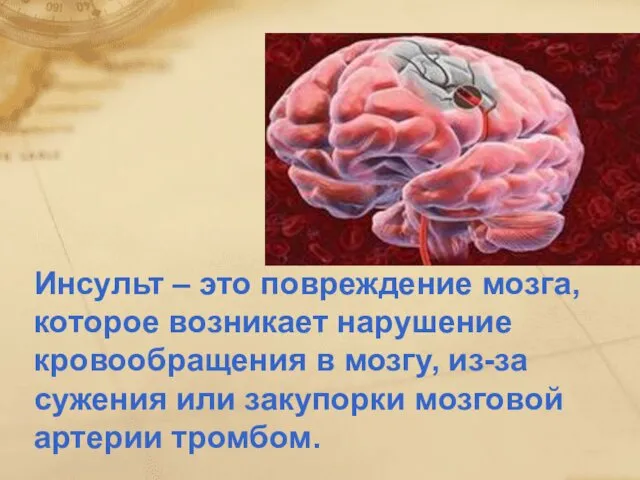 Инсульт – это повреждение мозга, которое возникает нарушение кровообращения в мозгу,