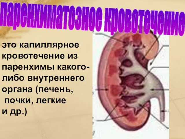 это капиллярное кровотечение из паренхимы какого-либо внутреннего органа (печень, почки, легкие и др.) паренхиматозное кровотечение