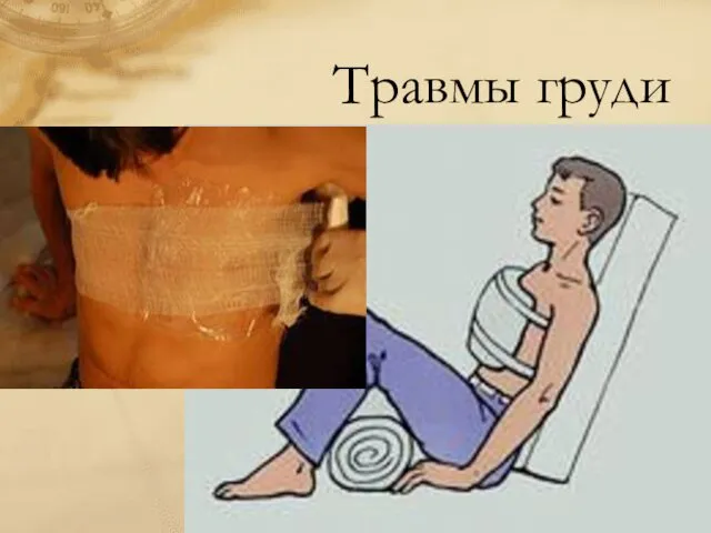 Травмы груди