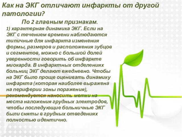 Как на ЭКГ отличают инфаркты от другой патологии? По 2 главным