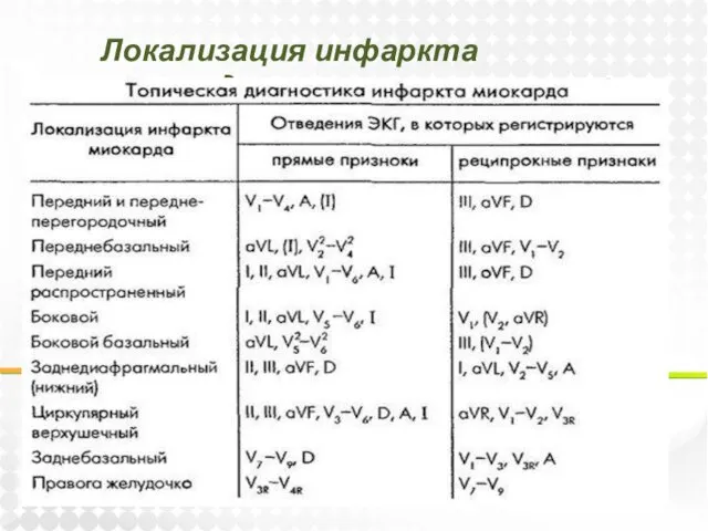 Локализация инфаркта миокарда