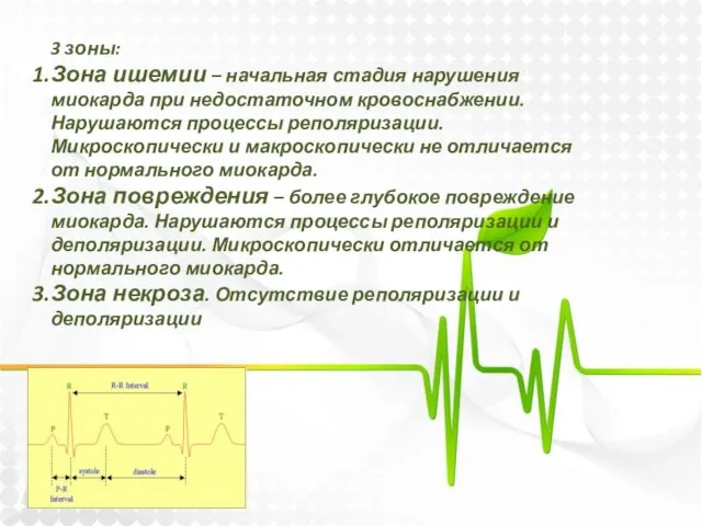 3 зоны: Зона ишемии – начальная стадия нарушения миокарда при недостаточном