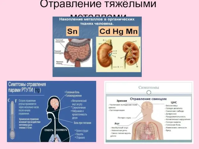 Отравление тяжёлыми металлами