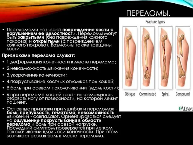 ПЕРЕЛОМЫ. Переломами называют повреждение кости с нарушением ее целостности. Переломы могут