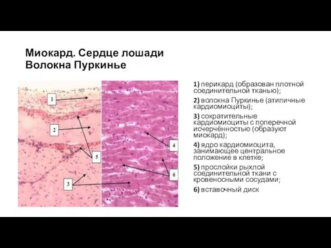 Миокард. Сердце лошади Волокна Пуркинье 1) перикард (образован плотной соединительной тканью);