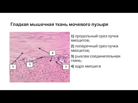 Гладкая мышечная ткань мочевого пузыря 1) продольный срез пучка миоцитов; 2)