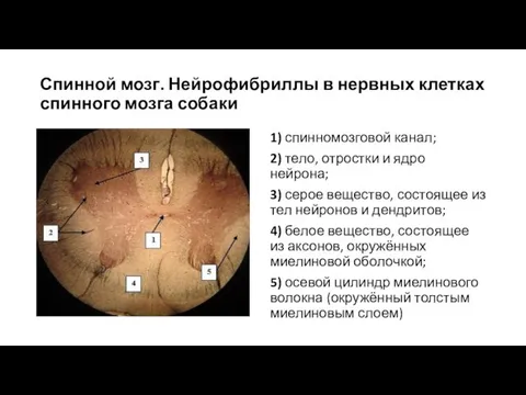 Спинной мозг. Нейрофибриллы в нервных клетках спинного мозга собаки 1) спинномозговой