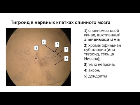 Тигроид в нервных клетках спинного мозга 1) спинномозговой канал, выстланный эпендимоцитами;